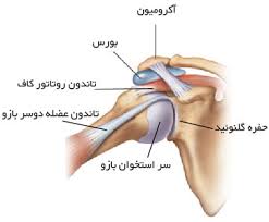 سندرم قوس دردناک